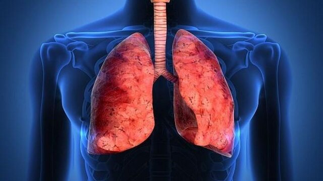 از کجا بدانیم ریه‌هایمان درگیر 