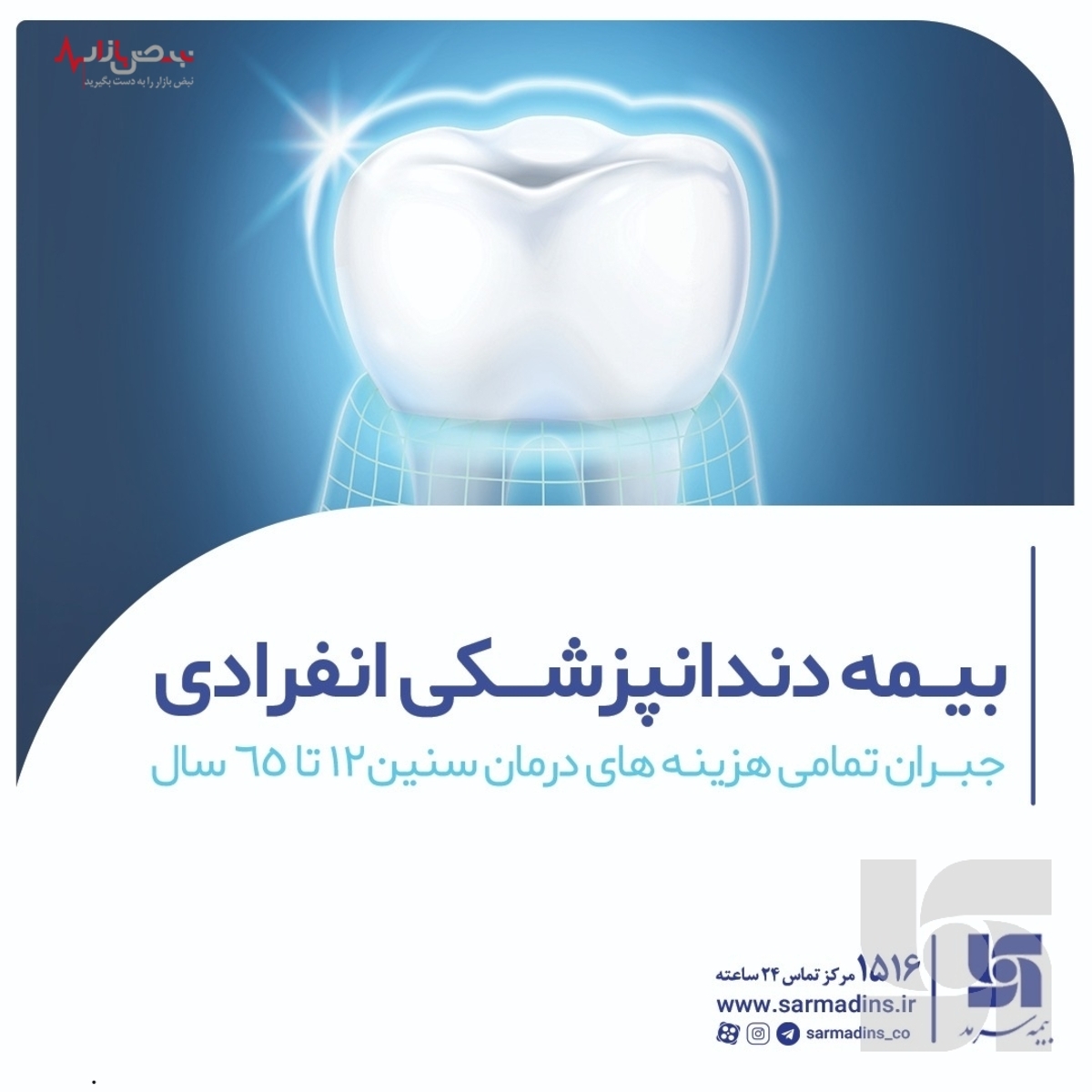 جبران تمام هزینه‌های دندانپزشکی با طرح جدید بیمه سرمد