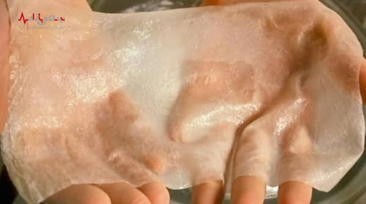 پیوند پوست سه بعدی، راه‌حل انقلابی برای پوست سوخته