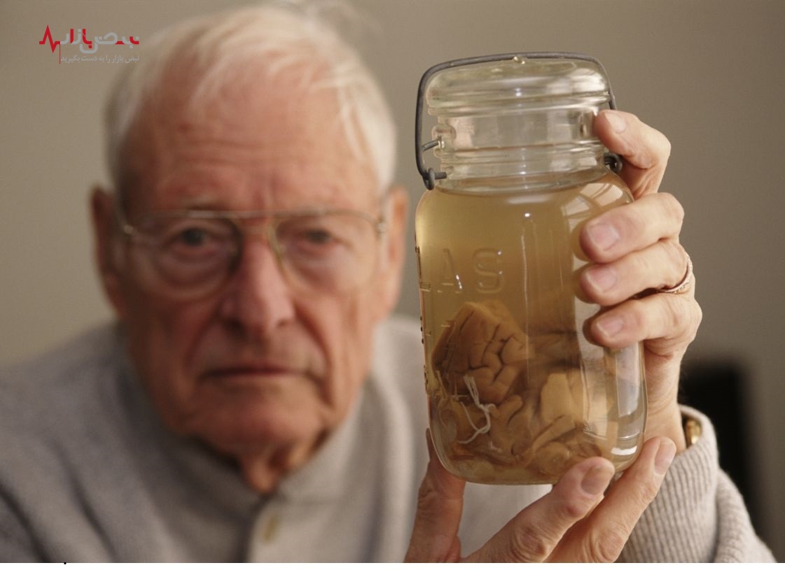 قطعه های مغز انیشتن کجاست ؟+عکس قطعه های مغز انیشتن کجاست ؟+عکس