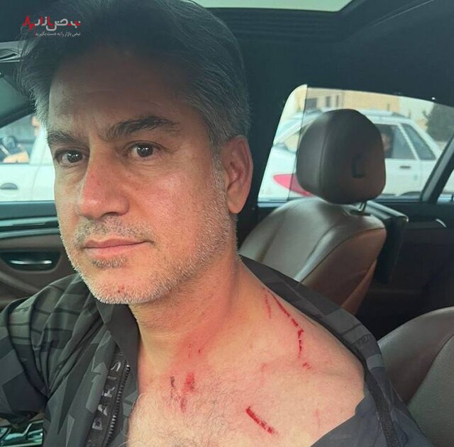 خطر از بیخ گوش حمید مطهری گذشت/جزئیات سرقت و زورگیری از مربی تیم ملی