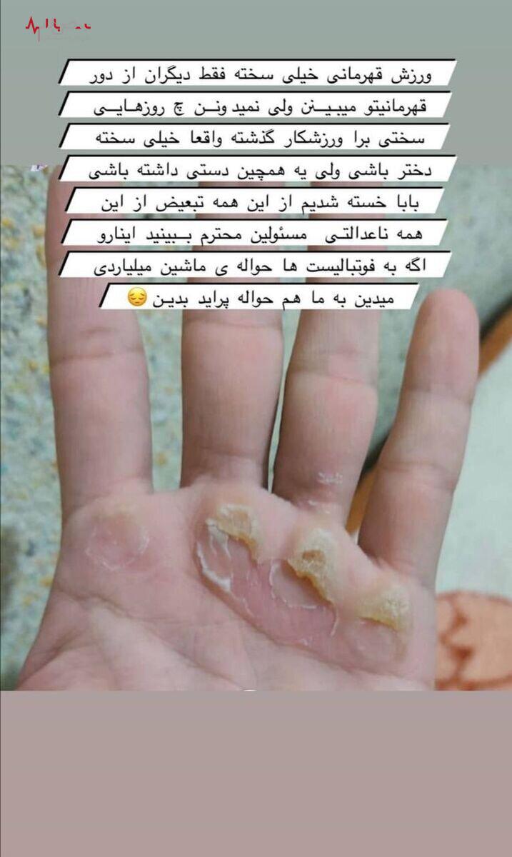 حمله تند یک دختر به کنعانی‌زادگان با تصویر  دستشهایش+عکس