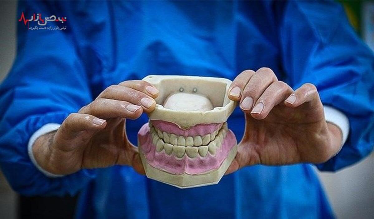 خدمات دندان‌پزشکی در بیمه سلامت افزایش یافت + مشمولان بخوانند
