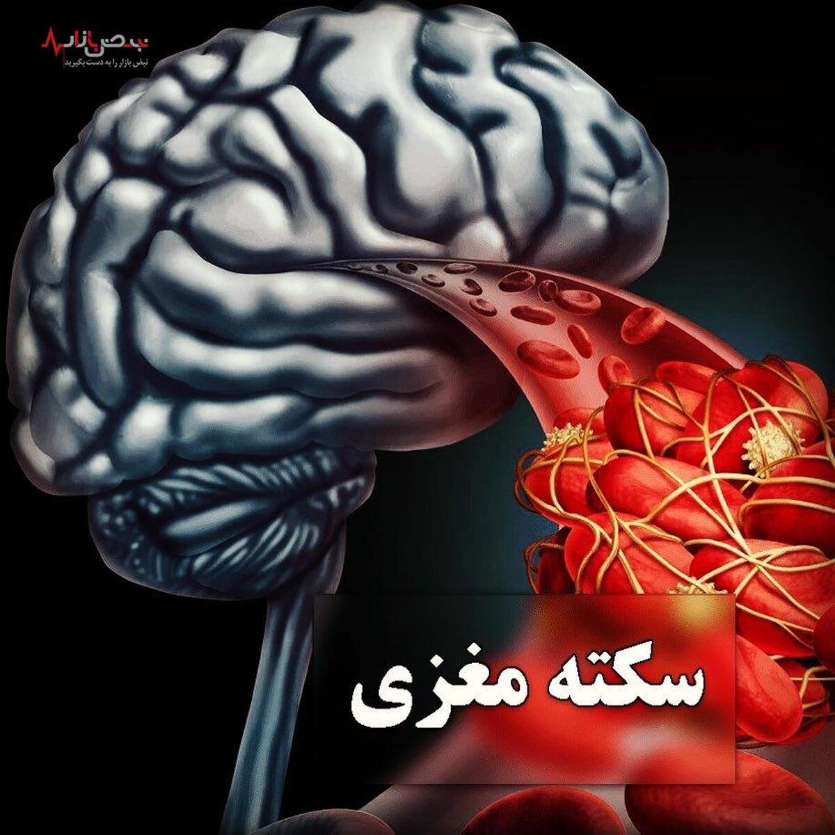 هوای گرم تابستان سکته مغزی را برای این افراد به ارمغان می‌آورد