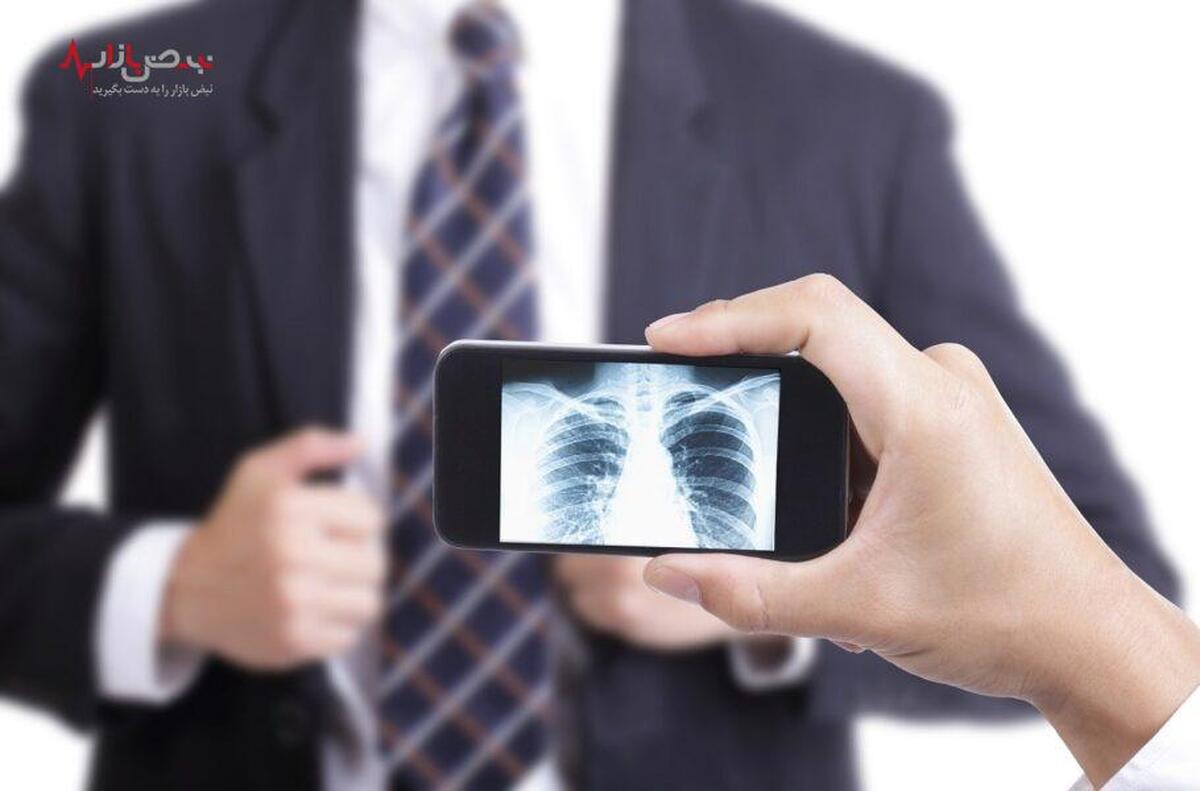 گوشی هوشمند تان را به دستگاه اشعه ایکس جیبی تبدیل کنید