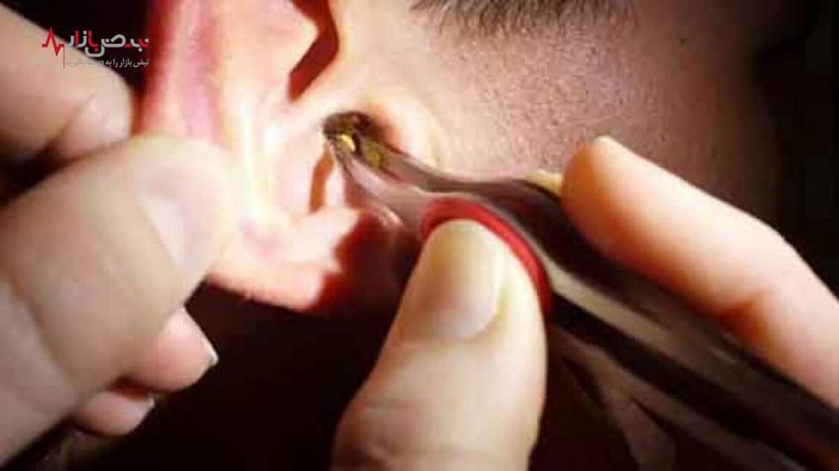 رازهای کثیف گوش شما که پزشکان پنهان میکنند