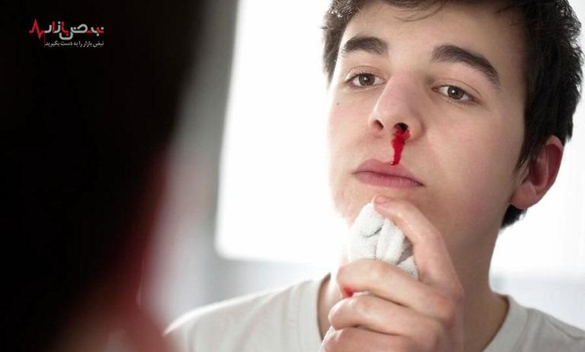 راهکارهای موثر برای جلوگیری از خونریزی بینی در تابستان