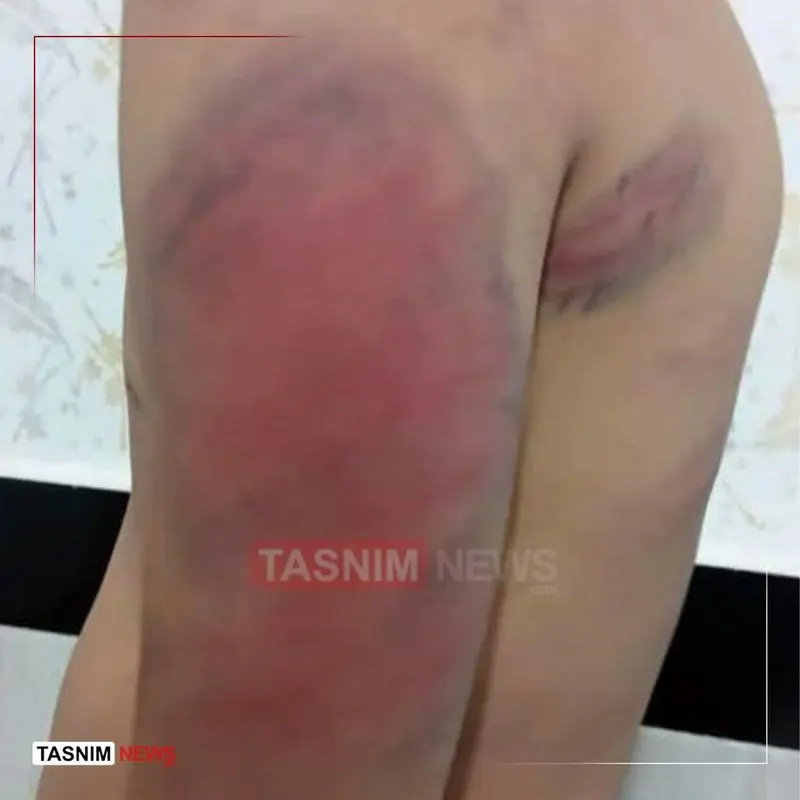 تنبیه بدنی دانش‌آموزان